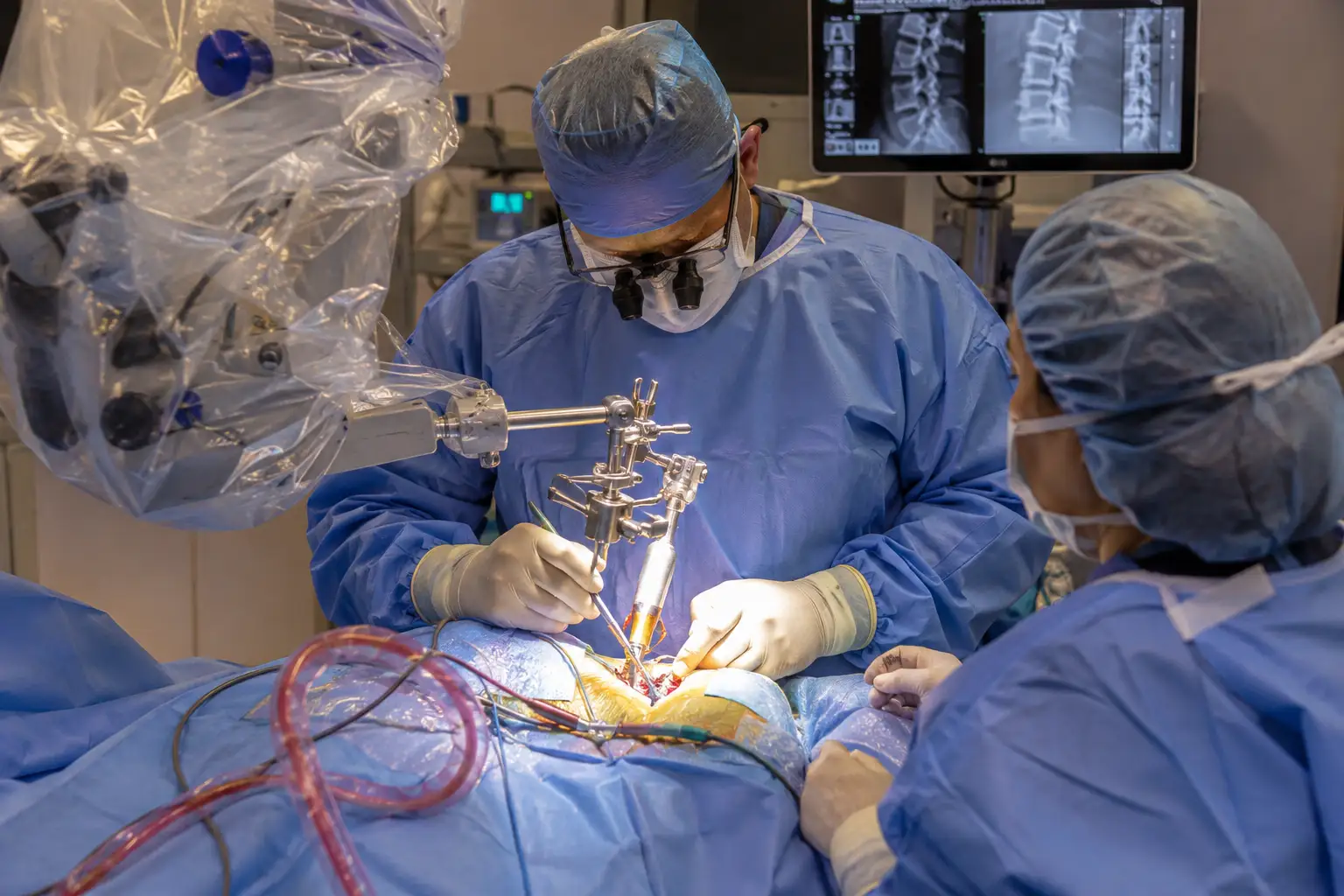Spine Surgery